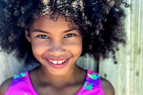 3 Ways to Prevent Hair Loss in Kids